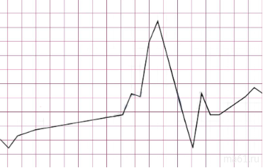 Прогноз цен на металл: апрель 2022 Прогноз цен на металл: апрель 2022
